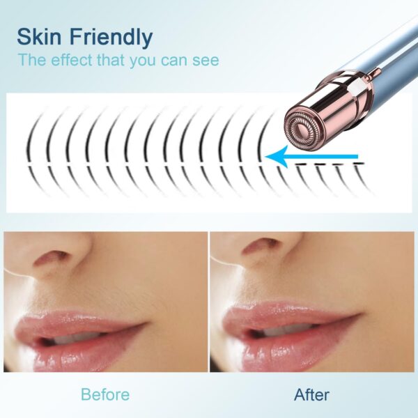 Facial Hair Removal for Women - Image 3